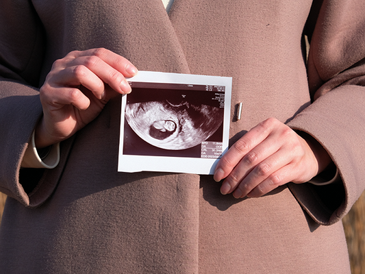 妊婦さんがエコー写真を持っている