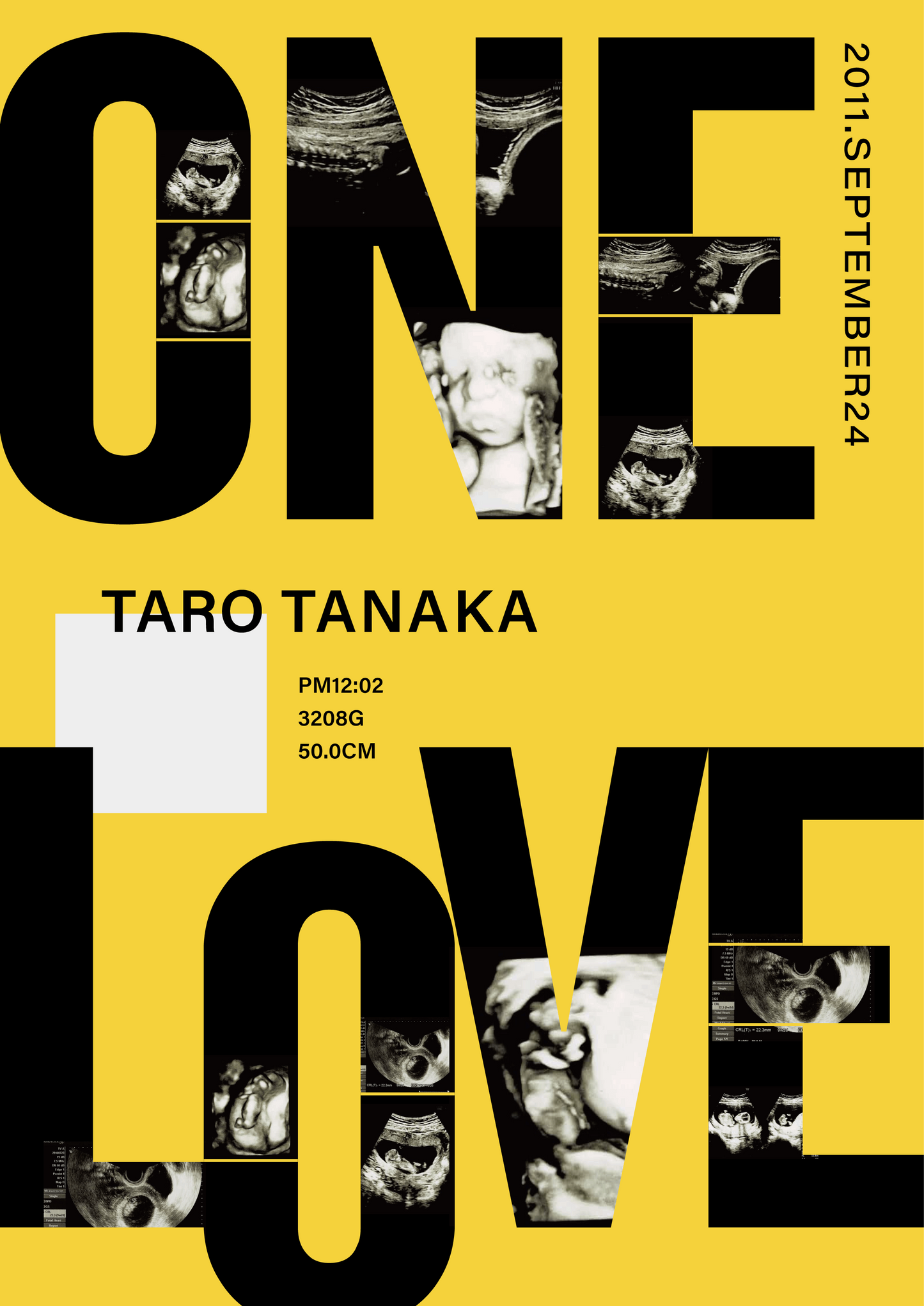 エコー写真ポスター One love