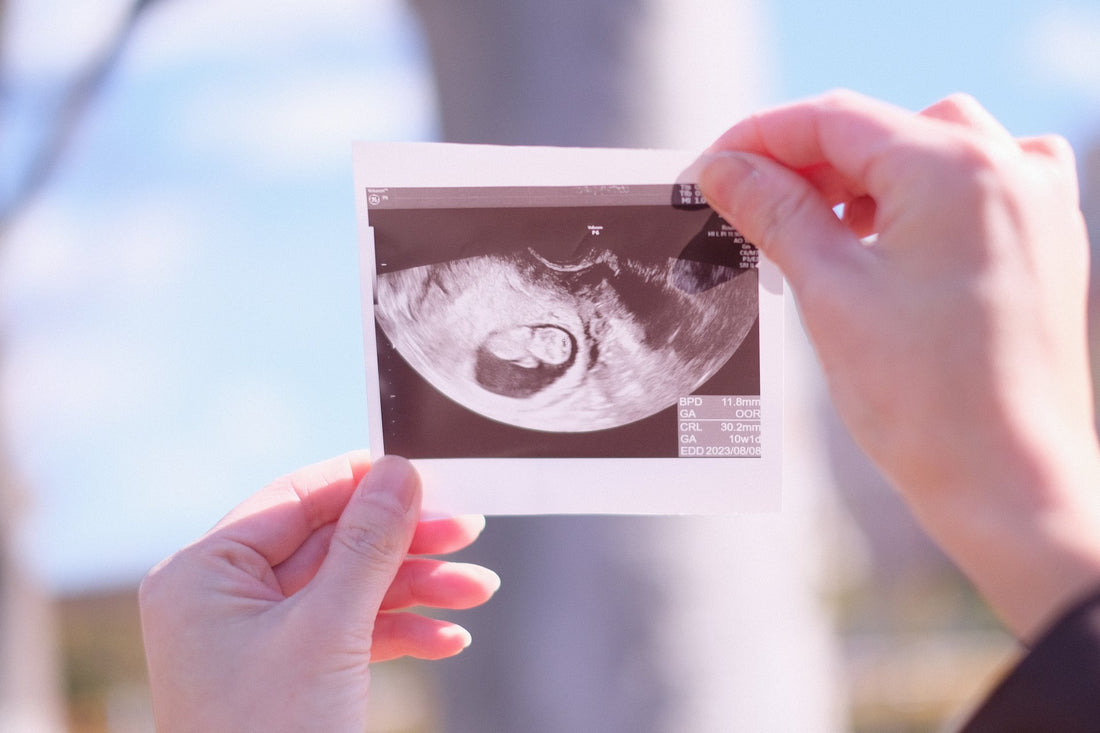 エコー写真が消える理由と最新の保存方法｜一生残したい最強アイデア10選