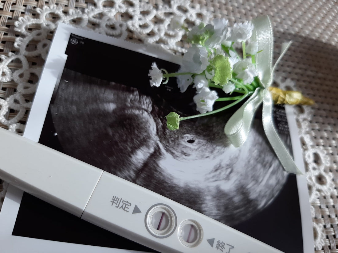 【完全版】エコー写真の残し方アイデア｜おしゃれで一生残る思い出ギフト10選