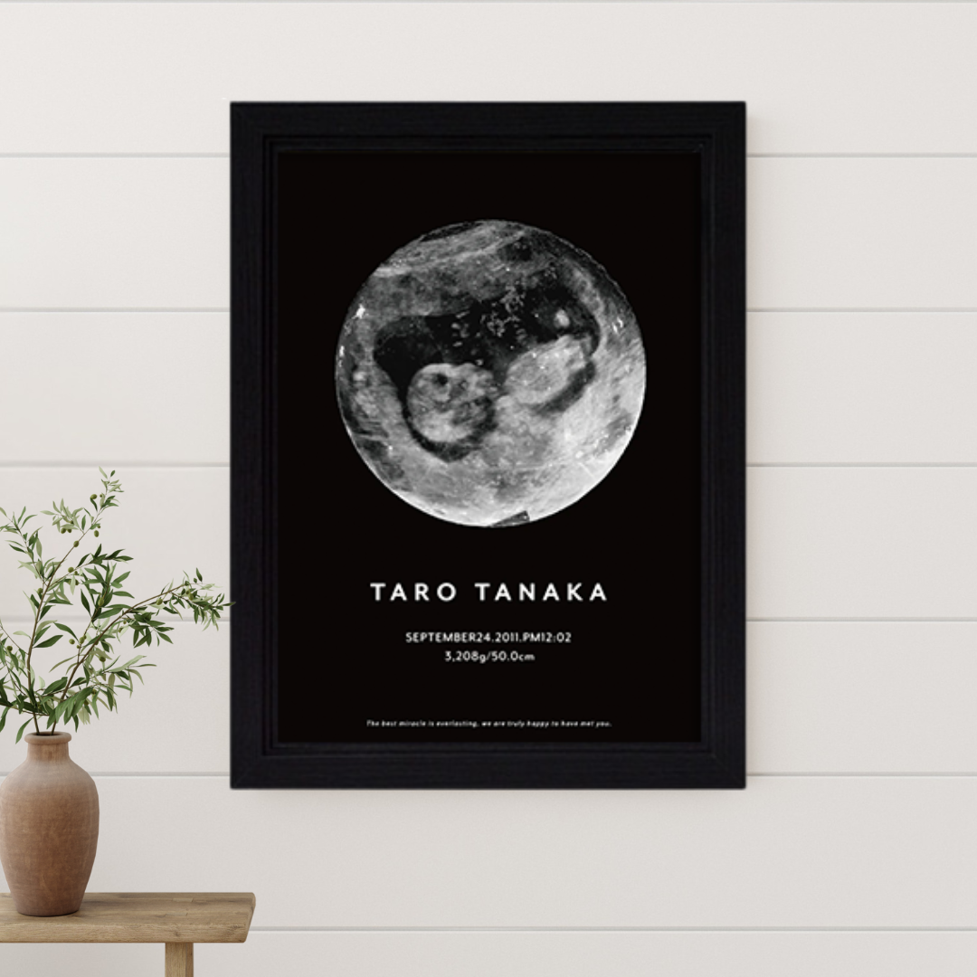Moon‐エコーポスター【エコー写真1枚】