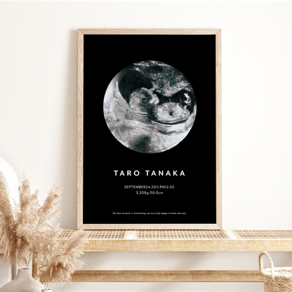 Moon‐エコーポスター【エコー写真1枚】