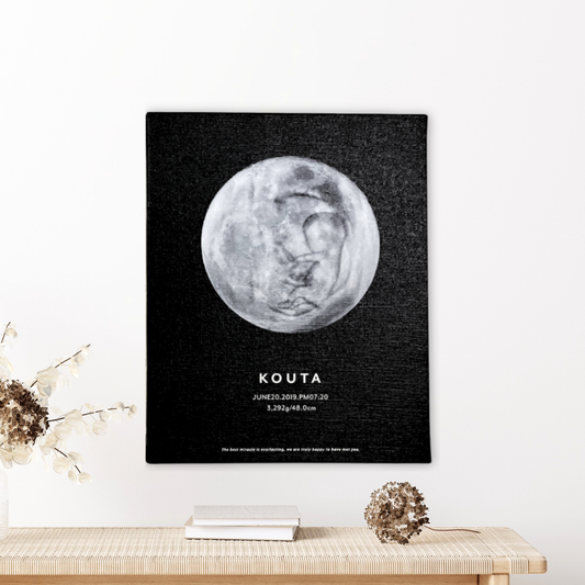 【セットでお得！30％OFF】Moon-エコーキャンバス（エコー写真1枚）